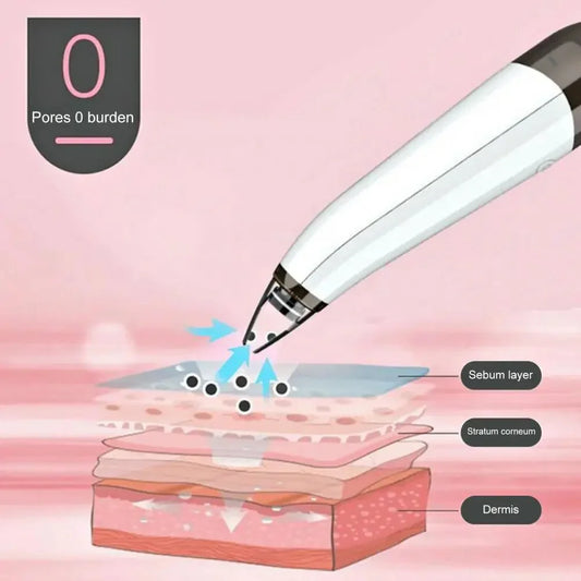 Acne Pore Cleaner & Black Head Remover With Cleaning Tools